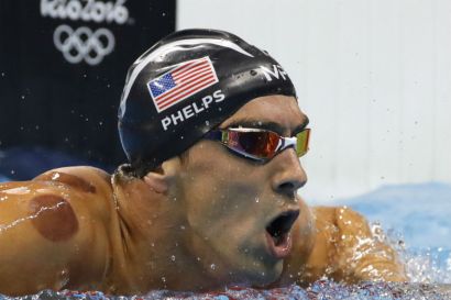 moratones michael phelps terapia con ventosas